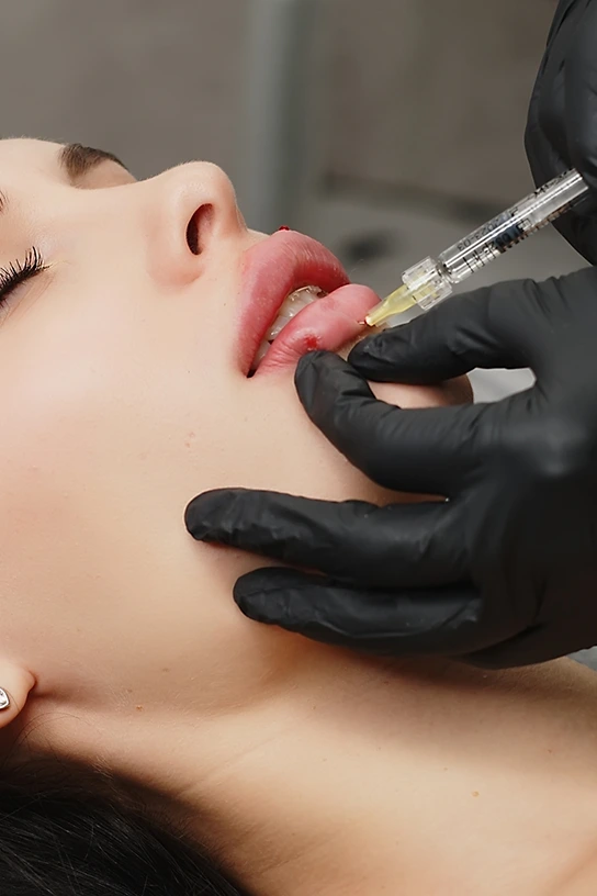 Lip Filler NYC: Type of Dermal Fillers We Use For Lip Augmentation Banner