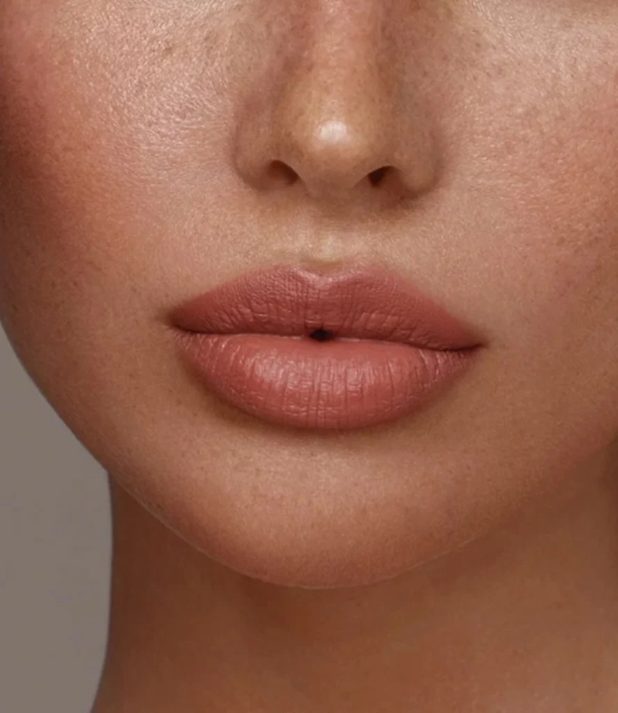 Lip Filler in NYC: What Are Lip Fillers? Banner