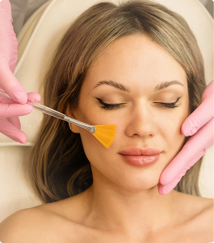 What Is a Chemical Peel? Banner