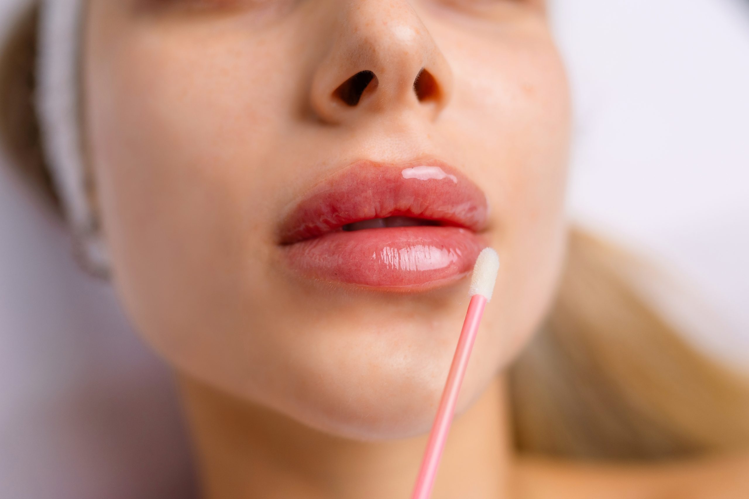 How Long Do Lip Fillers Last? Factors That Affect Longevity and Maintenance